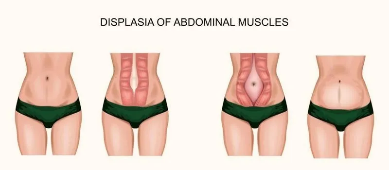 Fizjoterapia uroginekologiczna: jak wygląda terapia i czego możesz się spodziewać