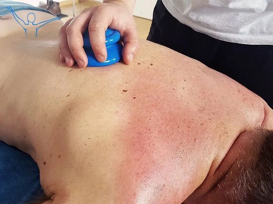 Jak samodzielnie wykonać skuteczny masaż bańką chińską w domu?