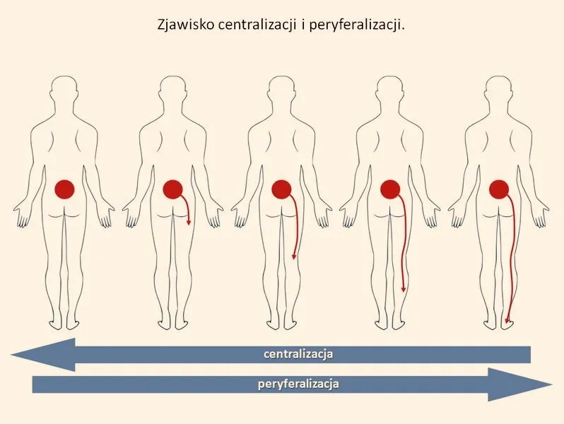 Terapia McKenzie – co warto wiedzieć o tej metodzie rehabilitacji?
