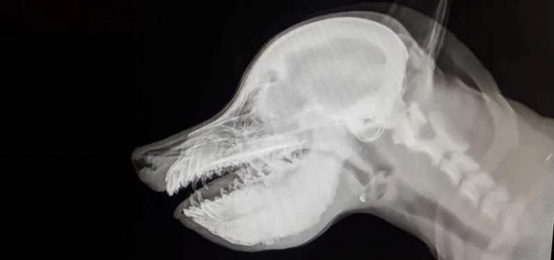 Osteopata vs fizjoterapeuta