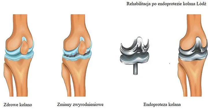 Proces powrotu do sprawności