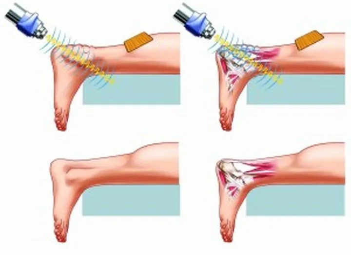 Reakcja na ból i kontuzje