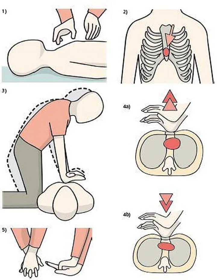 Uciśnięcia podczas masażu serca